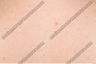 photo texture of white skin 0029